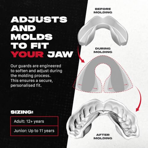 SAFEJAWZ Clear Fangz Mouth Guard, Adult Dual Layer Mouthguard with Case - color: Clear Fangz, size: Adult (12+)