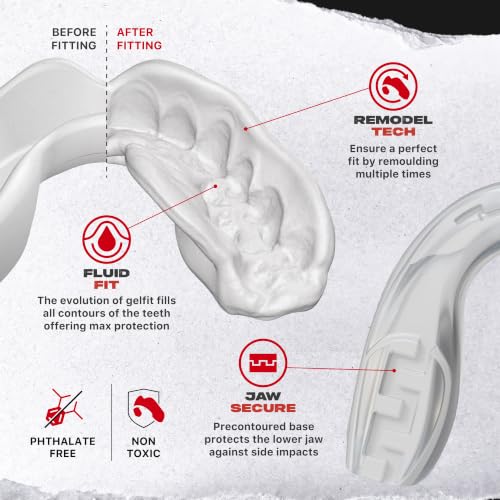 SAFEJAWZ Clear Fangz Mouth Guard, Adult Dual Layer Mouthguard with Case - color: Clear Fangz, size: Adult (12+)