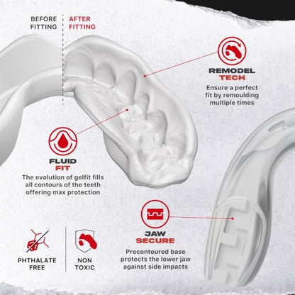 SAFEJAWZ Clear Fangz Mouth Guard, Adult Dual Layer Mouthguard with Case - color: Clear Fangz, size: Adult (12+)